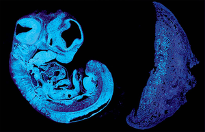 Fetus and placenta sections