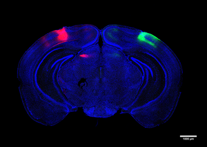 Cortices across hemispheres