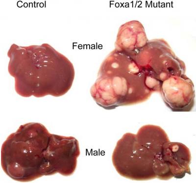 Foxa Factors Control Liver Cancer Risk