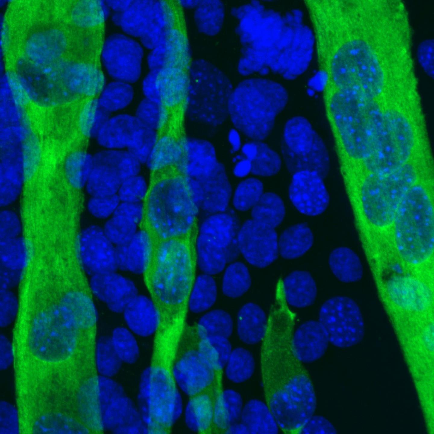Prox1 and Satellite Cells