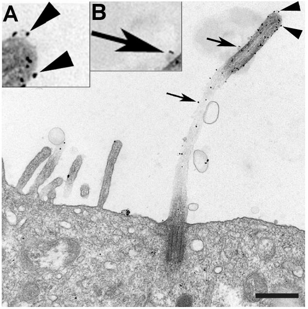 Exocyst Exoc5 Localizes to Both the Primary Cilium and Vesicles Associated with the Primary Cilium