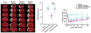 Representative results show the neuroprotective effect of Tat-SIRT5-CTM peptide against ischemic brain injury