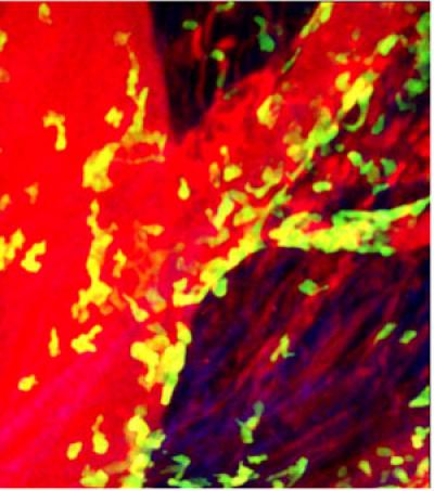 Scientists First to See Trafficking of Immune Cells in Beating Heart