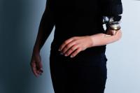 An Amputee Fitted with an Advanced Arm Prosthetic Following Tmsr Surgery