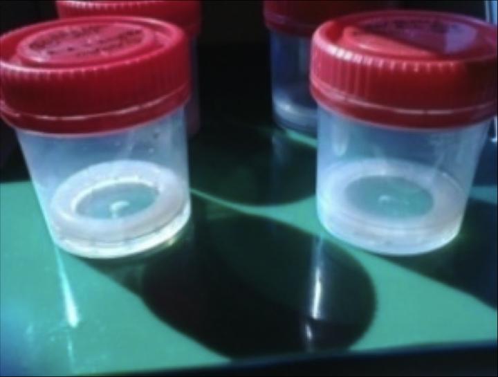 Making of the Vaginal Rings