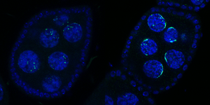 Rhino re-localizes to the pericentromeric Satellite arrays upon Kipferl mutation or deletion