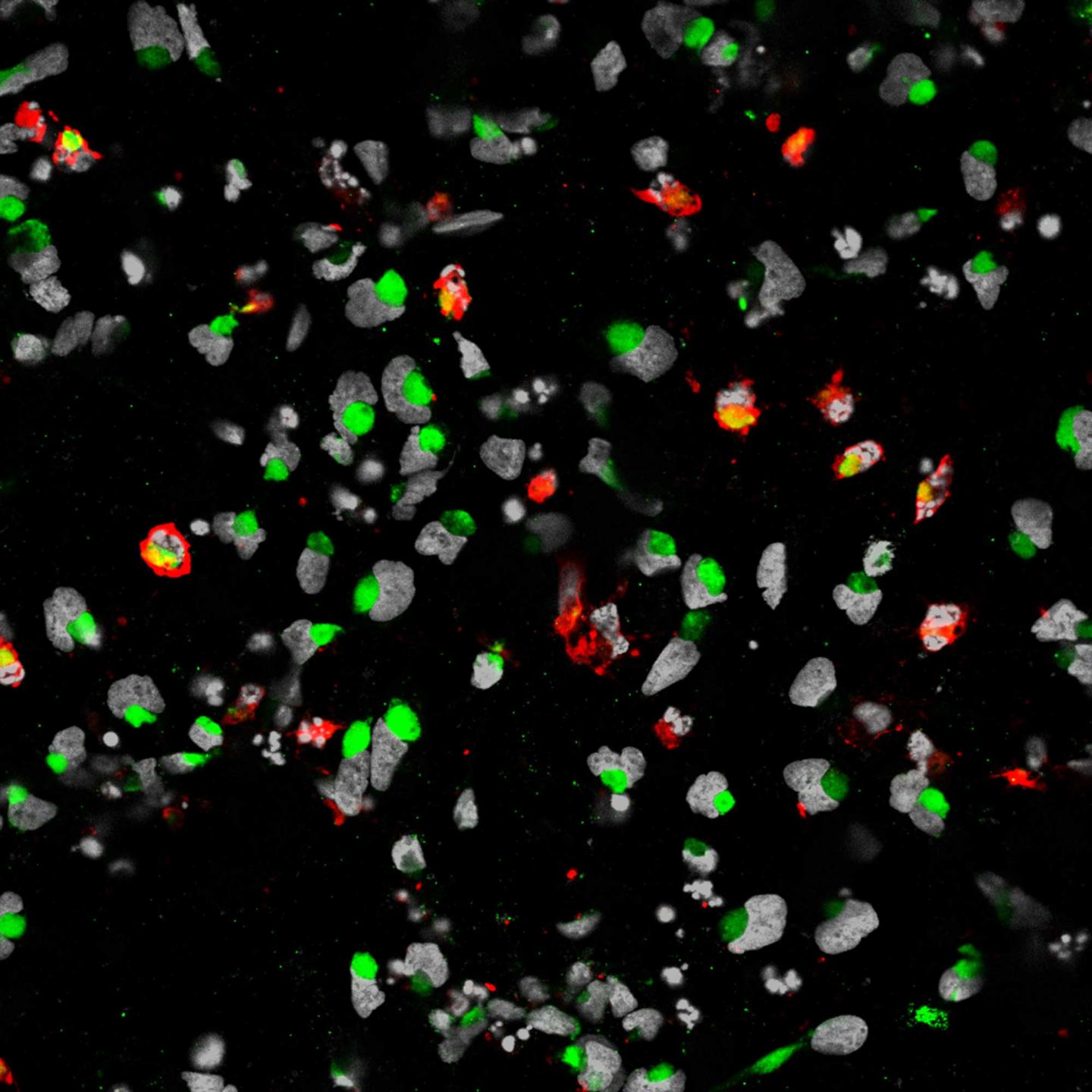 Cell Death of Human Neural Progenitor Cells by Zika Virus