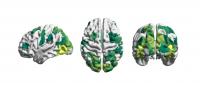 Brain Reconfiguration