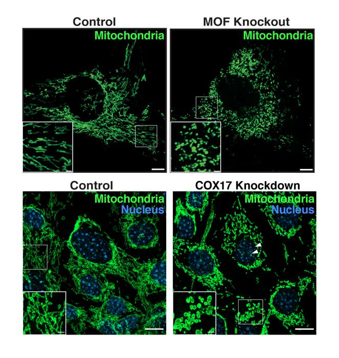 Healthy mitochondria existing as elongated network become fragmented and functionally deficient upon MOF and COX17 genetic depletion.