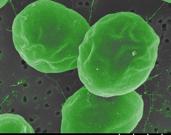 Microalgae vs. mercury