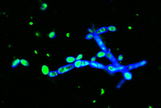 N2-Fixing Bacteria Pseudomonas Stutzeri