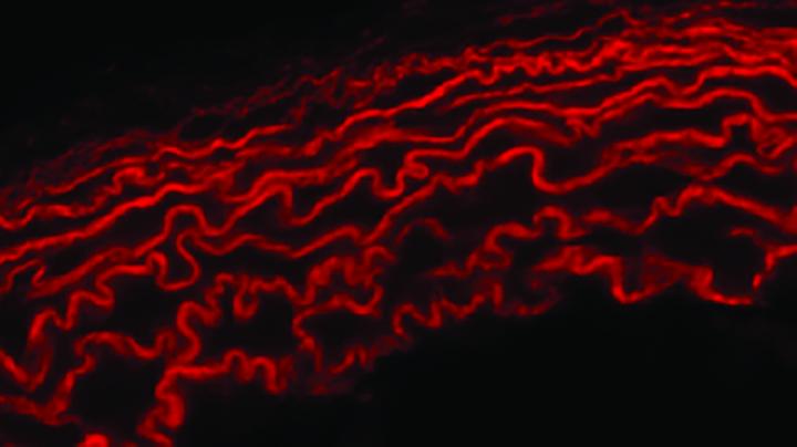 Engineers Examine Chemo-Mechanics of Heart Defect