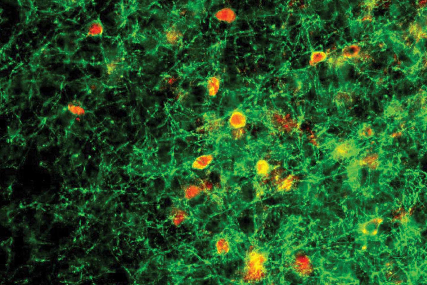 Abnormal Behavior of Parvalbumin (PV) Neurons