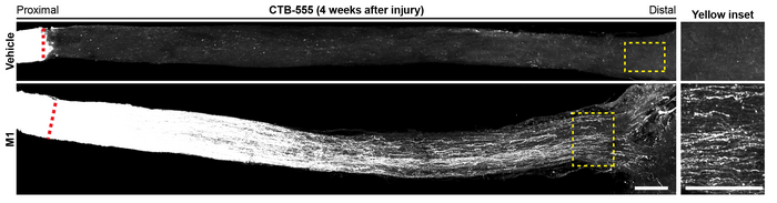 M1 induces sustained axon regeneration