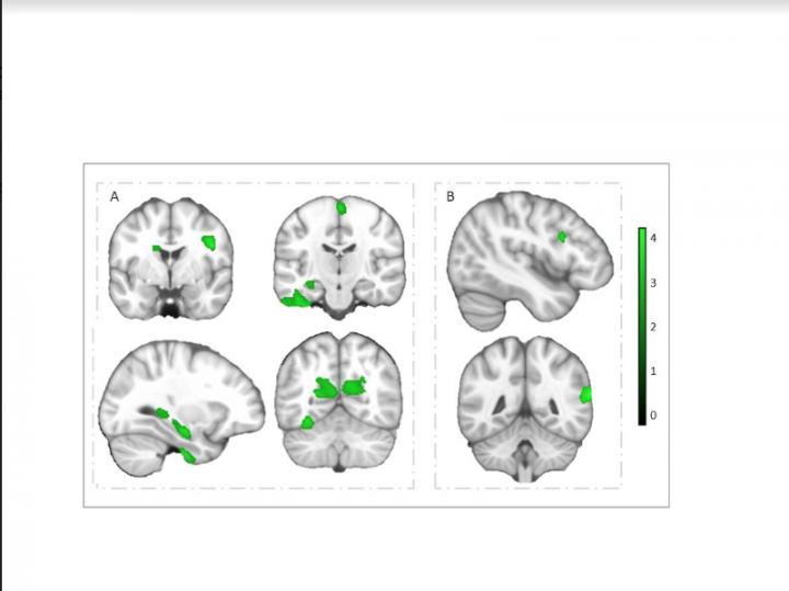 Brain Regions