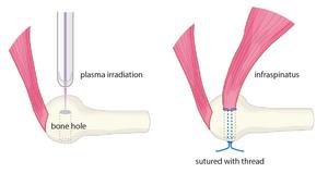 Rotator cuff tear repair in a rabbit model