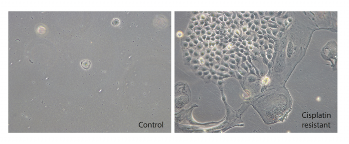 A culture of testicular germ cell tumor-cells under Cisplatin-treatment at day 28: