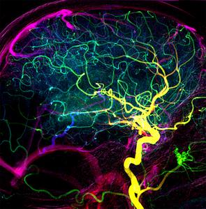 Blood vessels in the brain (early venous filling)