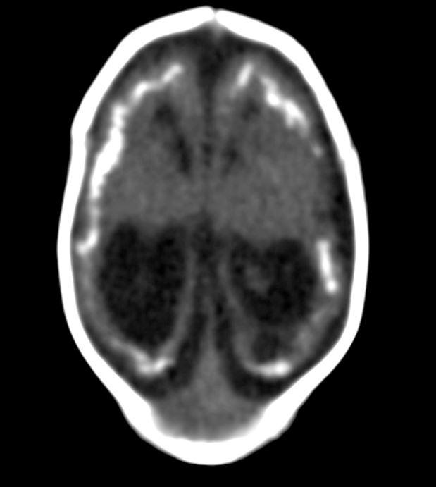 Figure 1: Unenhanced Head