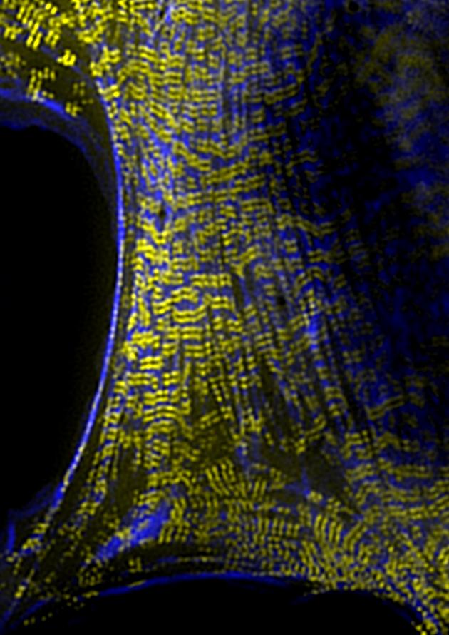 Myosin II Filament Stacks