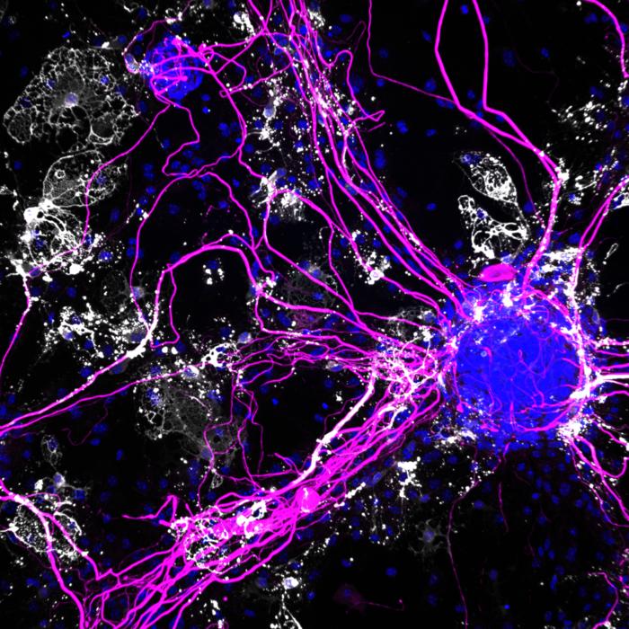 nerve fibers and oligodendrocytes