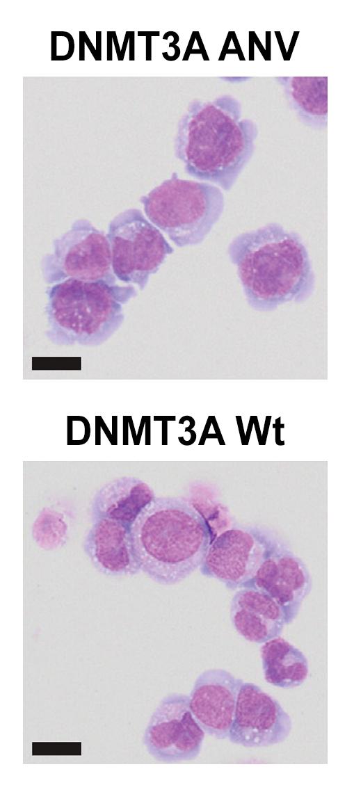 Human Leukemia Cells