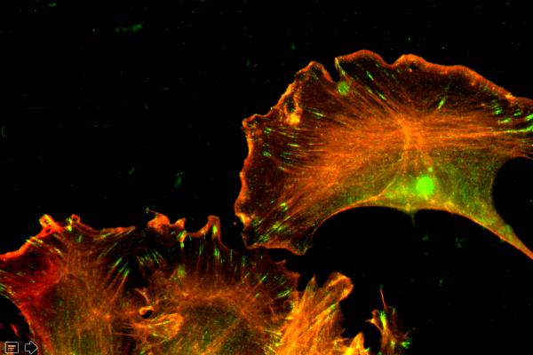 Actin Cytoskeleton