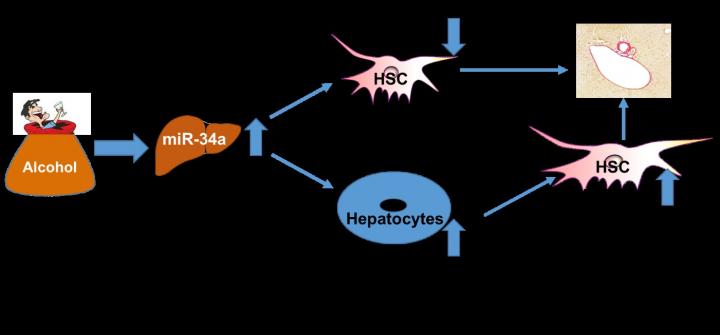 New study identifies targets to lessen the effects of alcoholic liver disease