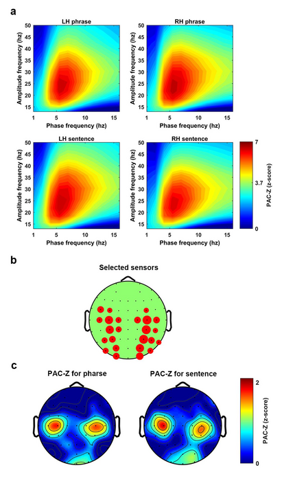 Fig 4. Phase amplitude coupling as a general mechanism for speech perception