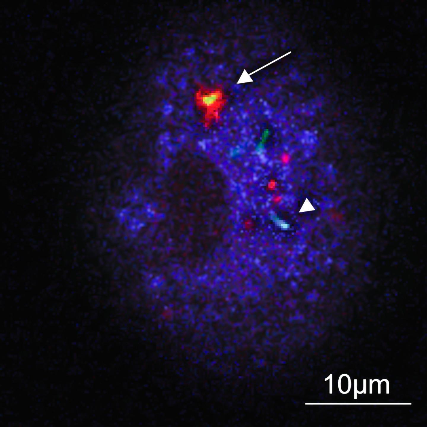 A Macrophage with Three Intracellular <i>Tuberculosis bacilli</i>