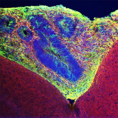 Gage Lab -- Organoid