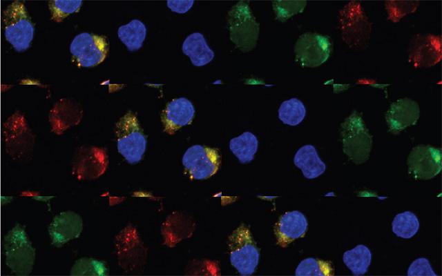 Leukemia cells, University of California San Diego