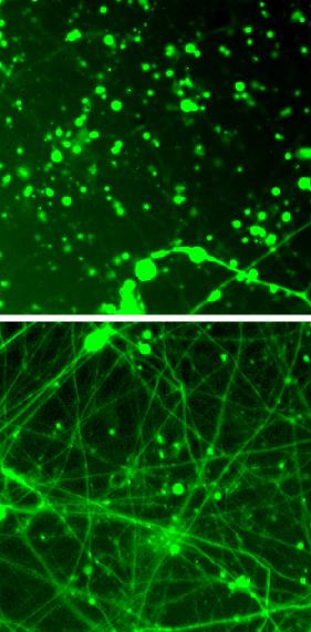 Tamping down Neurons' Energy Use Could Treat Neurodegeneration