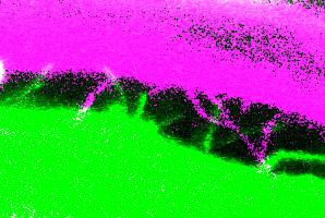 Filopodia of the Blood Vessels