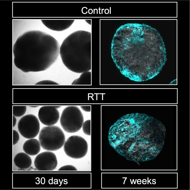 Patient derived 3D brain organoid