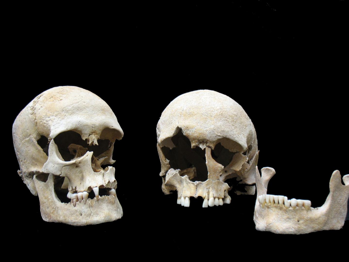 Ancient Plague Victims