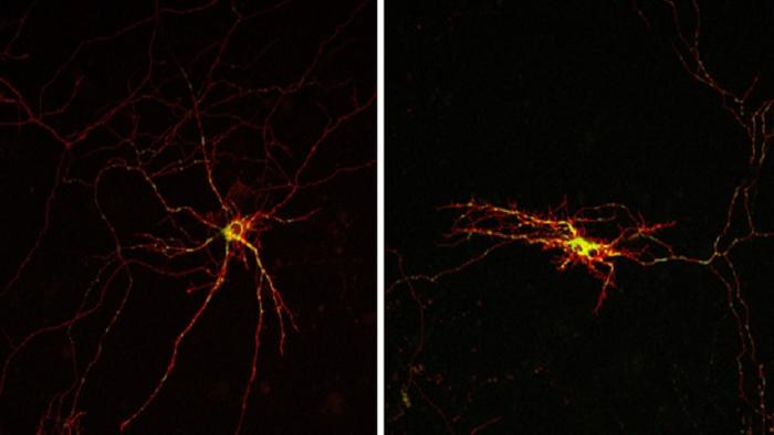 A study finds a molecular mechanism related to neuronal death