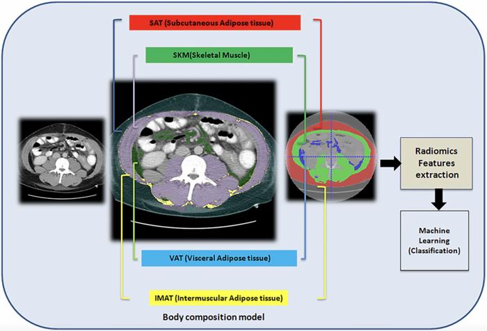 Computed tomography-based radiomics and body composition model for predicting hepatic decompensation