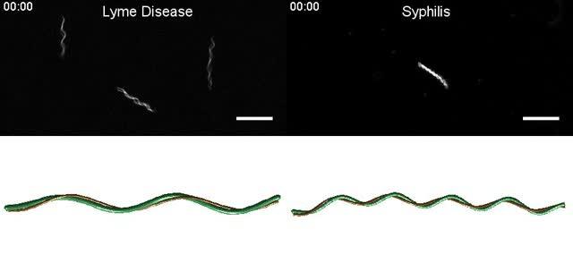 New Findings Could Help Target the Bacteria that Cause Lyme Disease and Syphilis