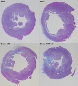 Human MITO cells suppress myocardial fibrosis during cardiac regeneration