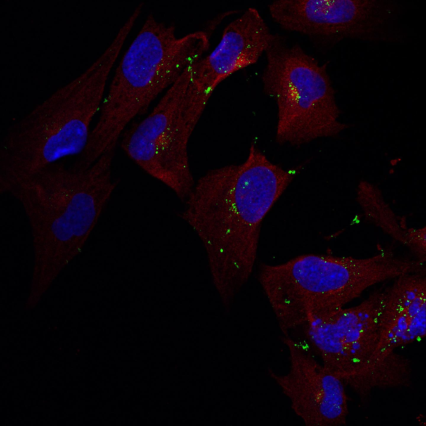 Brain Immune Cells, Called Microglia