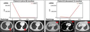 Circulating tumor DNA (ctDNA) correlates with radiology disease assessment and patient outcome