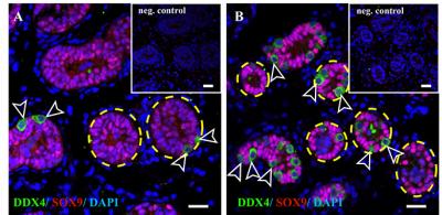 Germ Cells