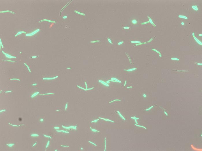 Bacteria change shape when confronted with antibiotics