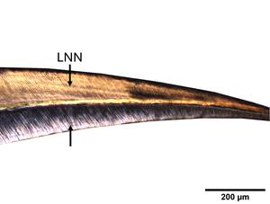 Reconstructing infant mortality in Iberian Iron Age populations from tooth histology