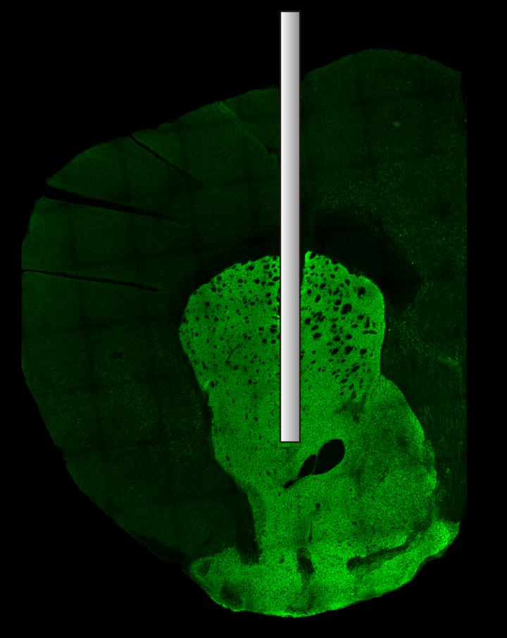 Activity in Neuronal Tissue Can Be Optically Recorded with Fiber Optics