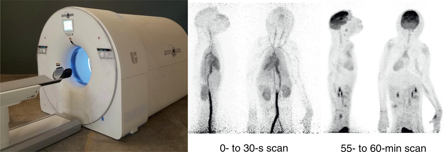 EXPLORER Scanner and Images from Mini-EXPLORER Dynamic Total-body Imaging Study