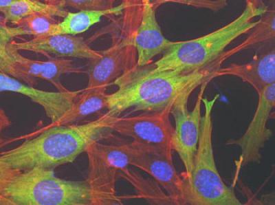 AMPK Signaling: Got Food?