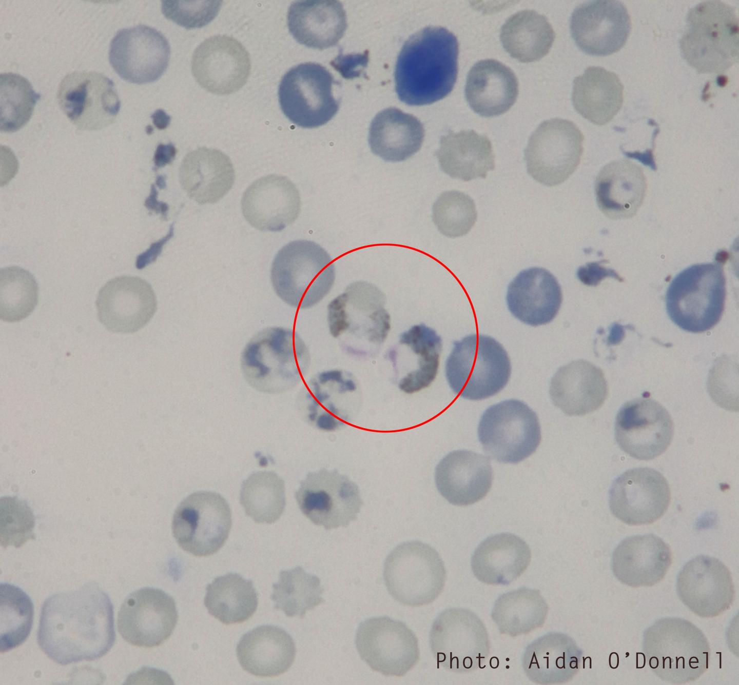 Malaria Parasites