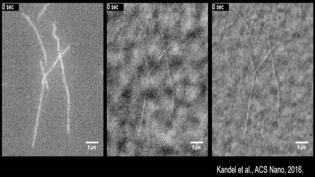 Researchers Develop Label-Free Technique to Image Microtubules